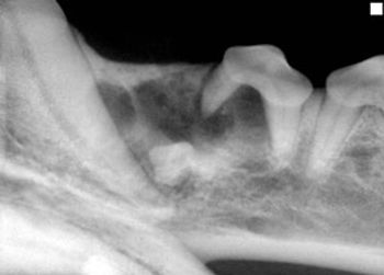 Dentigerous1-572618-1384533125097.jpg