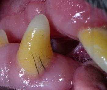 hairteeth2-something.jpg