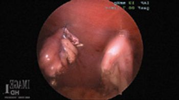 surgStat_fig2_t-701991-1384213487260.jpg