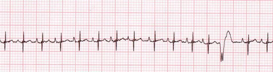 Reading Ecgs In Veterinary Patients An Introduction