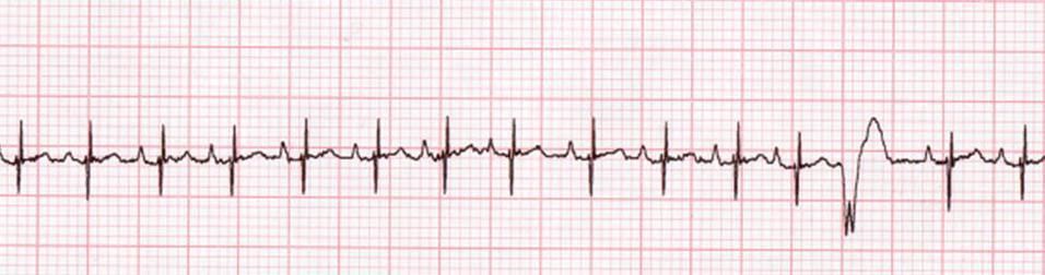 Reading Ecgs In Veterinary Patients An Introduction Reading Ecgs In Veterinary Patients An Introduction
