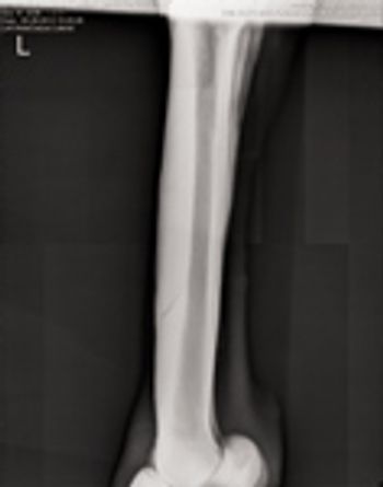 Veterinary_kane_Bucked_Shins-1-801501-1384154572540.jpg