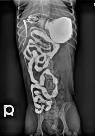 Skills Laboratory: How to perform a positive contrast gastrointestinal ...
