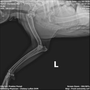 Case study: A puzzling limp