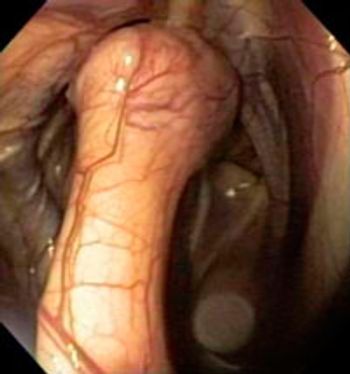 Desrochers_Vestibular2B_200-737122-1384185755865.jpg