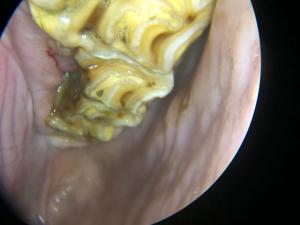 periodontal disease in horses