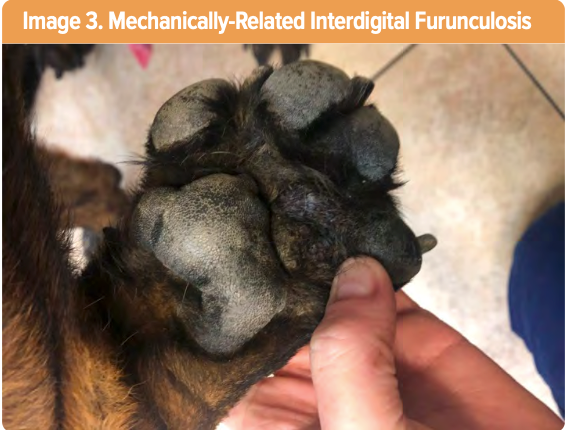 Interdigital furunculosis: medical and surgical options