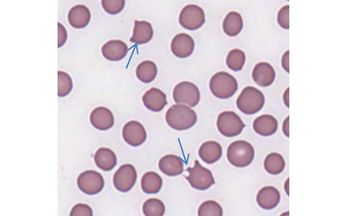 keratocyte-450.jpg