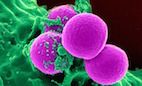 Cell-Penetrating Peptide Targets Senescent Cells to Restore Tissue Function | dvm360 Cell-Penetrating Peptide Targets Senescent Cells to Restore Tissue Function | dvm360