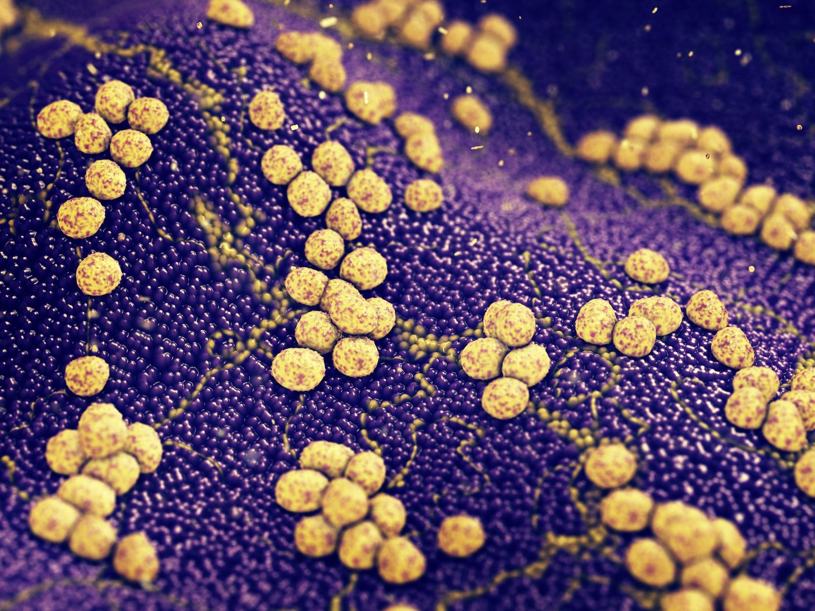 Staphylococcus aureus