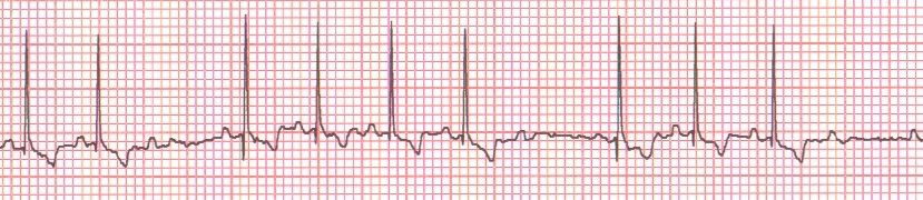 Reading Ecgs In Veterinary Patients An Introduction