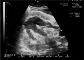 i8_t-729623-1384189860908.jpg