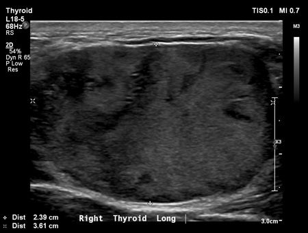 Canine thyroid carcinoma in 4-year-old American bulldog: Radiology ...