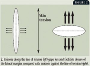 Figure2_t-651712-1384336813624.jpg