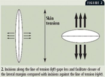 Figure2_t-651712-1384336813624.jpg