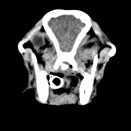 Transverse view CT