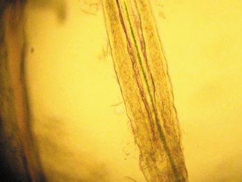 Photo-5-Dermatophyte-on-trichogram.jpg