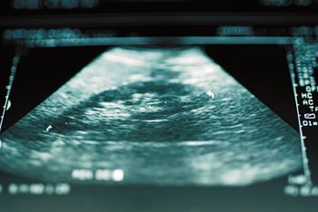 veterinary_ultrasound_450px_71445779.jpg