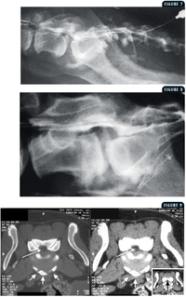 Degenerative Lumbosacral Stenosis In Dogs