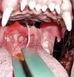 Dog Surgery Spotlight: Treating an Elongated Soft Palate in Brachycephalic  Dogs - Maryland Veterinary Surgical Services