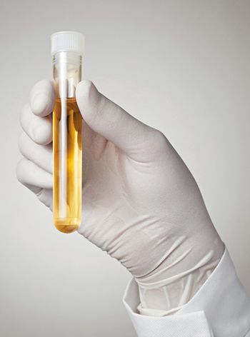 veterinary_urine-sample_450px_476699617.jpg