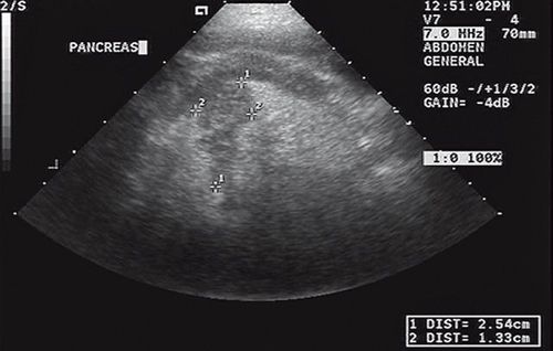 Serial serum pancreatic lipase immunoreactivity concentrations in a dog ...