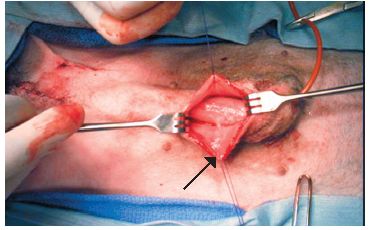 A Challenging Case Phimosis In A Young Adult Dog