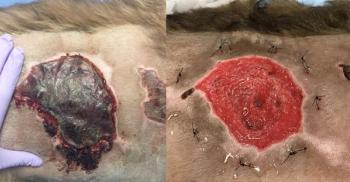 wound management using honey