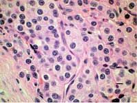 Fig2ThyroidPhotomicrograph-615184-1384502046582.jpg
