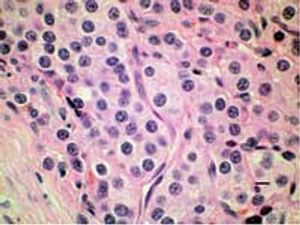 Fig2ThyroidPhotomicrograph-615184-1384502046582.jpg