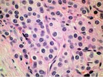Fig2ThyroidPhotomicrograph-615184-1384502046582.jpg