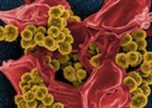 ACVP 2017: Clostridium difficile Infection - An Emerging Zoonosis?