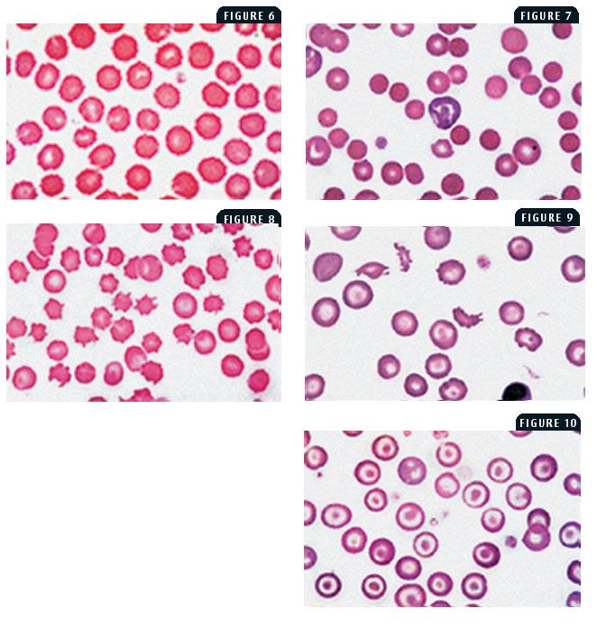 Normal Rbc Vet Med What Is The Normal Rbc Count For Dogs