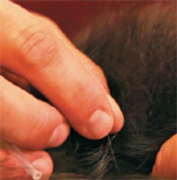 veterinary_rehab_myoneedle2-793275-1384155985947.jpg