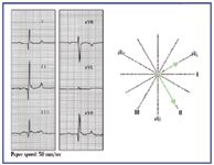 Skills Laboratory: How to determine and interpret the mean electrical axis