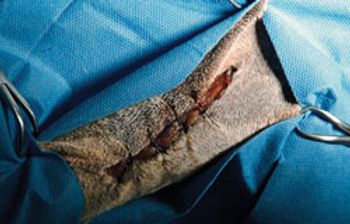 Vet_presuture_250x160_thumbnail-592926-1384513026400.jpg