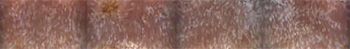 Alicam_Dilated-lacteals_450.jpg