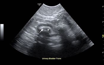 Romine_cystitis_Figure2B_450.jpg