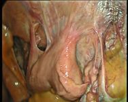 veterinary_kane1010_Uterope-688906-1384229095387.jpg