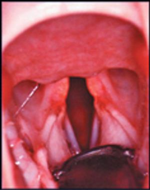 SurgSTAT-Figure1a-729123-1384188944871.jpg