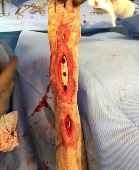 Dycus_Intraoperative_MIPO_2_450.jpg