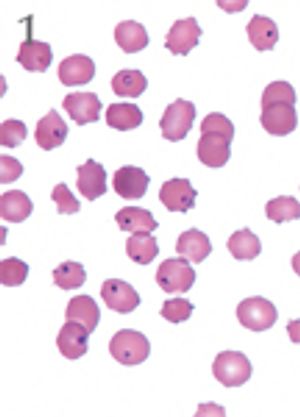 veterinary_Cytaux_in_blood 1000x h_Fig1-775776-1384161102194.jpg