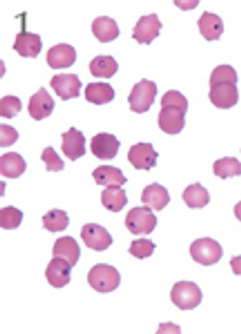 veterinary_Cytaux_in_blood 1000x h_Fig1-775776-1384161102194.jpg