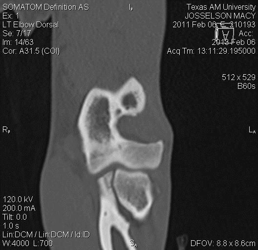 Treatment of forelimb disorders in dogs (Proceedings)