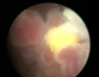 veterinary_TCC_Rounds_Figure1_cystoscopy_460.jpg