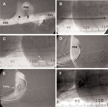 dvm0112_Weiss_Figure 2-ihpss_example-754712-1384165180151.jpg