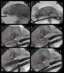 4_veterinary_dvm1011_Berent_FIgure-4-NPS-41312840-611540_t-742265-1384181516722.jpg