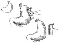Figure1-650422-1384344647207.jpg