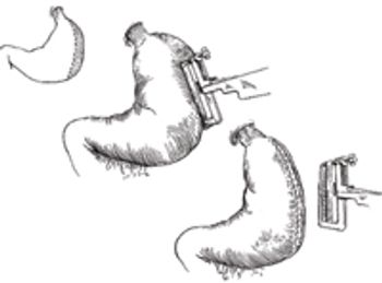 Figure1-650422-1384344647207.jpg