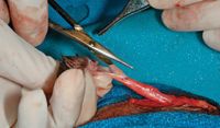 SurgStat_Fig1_t-672671-1384320348595.jpg